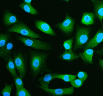 Immunofluorescent staining of SPRED1 using anti-SPRED1 antibody (green). SPRED1 was detected in an immunocytochemical section of cells. Enzyme antigen retrieval was performed using IHC enzyme antigen retrieval reagent for 15 mins. The cells were blocked with 10% goat serum. And then incubated with 5 ug/ml rabbit anti-SPRED1 antibody overnight at 4oC. DyLight 488 Conjugated Goat Anti-Rabbit IgG was used as secondary antibody at 1:500 dilution and incubated for 30 minutes at 37oC. The section was counterstained with DAPI nuclear stain (blue). Visualize using a fluorescence microscope and filter sets appropriate for the label used.