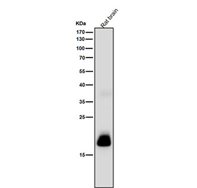 Rat brain tissue lysate tested with CRP antibody at 1:1000 dilution for 1 hour at room temperature. A predominant band is detected at ~17 kDa, consistent with proteolytically processed CRP fragments; other antibodies may detect the ~23-26 kDa monomer under the same conditions.