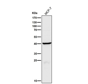 Human MCF7 cell lysate tested with the CTSH antibody at 1:1000 dilution for 1 hour at room temperature. Predicted molecular weight ~37 kDa.