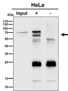 Immunoprecipitation analysis using the antibody at 1:50 dilution. Western blot at 1:1000 dilution. Major bands are observed near 60 kDa and 70 kDa, with the upper species appearing as a doublet, consistent with phosphorylated and unmodified forms of PPP2R5D (predicted ~66 kDa).