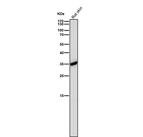 All lanes use the CASP6 antibody at 1:1K dilution for 1 hour at room temperature. Expected molecular weight: 34-36 kDa.