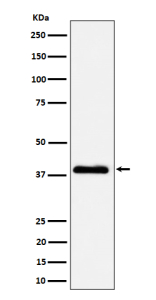 Western blot analysis of NSDHL expression in A431 cell lysate using NSDHL antibody. The expected molecular weight of NSDHL is ~42 kDa.