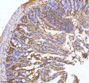 Immunohistochemical staining of PAFAH1B2 using anti-PAFAH1B2 antibody. PAFAH1B2 was detected in a paraffin-embedded section of rat colon tissue. Heat mediated antigen retrieval was performed in EDTA buffer (pH 8.0, epitope retrieval solution). The tissue section was blocked with 10% goat serum. The tissue section was then incubated with 2 ug/ml rabbit anti-PAFAH1B2 antibody overnight at 4oC. Peroxidase Conjugated Goat Anti-rabbit IgG was used as secondary antibody and incubated for 30 minutes at 37oC. The tissue section was developed using an HRP secondary and DAB substrate.