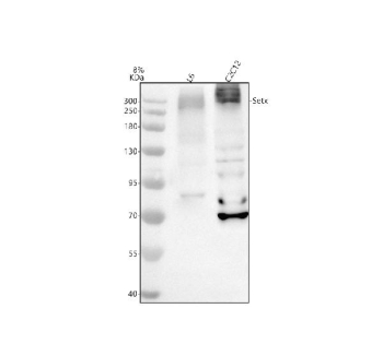 Western blot analysis of SETX using anti-SETX antibody. Electrophoresis was performed on a 8% SDS-PAGE gel at 80V (Stacking gel) / 120V (Resolving gel) for 2 hours. Lane 1: rat L6 whole cell lysates, Lane 2: mouse C2C12 whole cell lysates. After electrophoresis, proteins were transferred to a nitrocellulose membrane at 150 mA for 50-90 minutes. Blocked the membrane with 5% non-fat milk/TBS for 1.5 hour at RT. The membrane was incubated with rabbit anti-SETX antibody at 0.5 ug/ml overnight at 4oC, then washed with TBS-0.1%Tween 3 times with 5 minutes each and probed with a goat anti-rabbit IgG-HRP secondary antibody at a dilution of 1:5000 for 1.5 hour at RT. The signal was developed using an ECL Plus Western Blotting Substrate. A band is observed near ~300 kDa together with higher-molecular-weight species forming a ladder. These upper bands are consistent with poly-ubiquitinated/SUMO-modified or complexed forms of SETX, which are well documented for this large nuclear helicase involved in R-loop control.