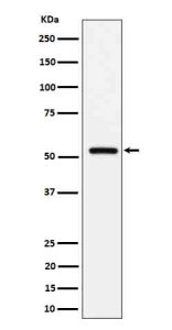 Western blot analysis of Fetuin B expression in human serum cell lysate using FETUB antibody. A band just above 50 kDa is observed. The higher apparent size relative to the predicted ~42 kDa is consistent with glycosylated, secreted Fetuin-B.