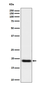 Western blot analysis of TNFAIP8 expression in human A549 cell lysate using TNFAIP8 antibody. TNFAIP8 western blot shows a predominant band at ~19 kDa. Although the predicted mass is ~23 kDa, TNFAIP8 commonly migrates at ~18-21 kDa due to electrophoretic mobility characteristics of small acidic proteins and possible isoform/alternative-start usage.
