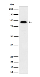 Western blot analysis of IFT88 expression in human HepG2 cell lysate using IFT88 antibody. Predicted molecular weight ~94 kDa.