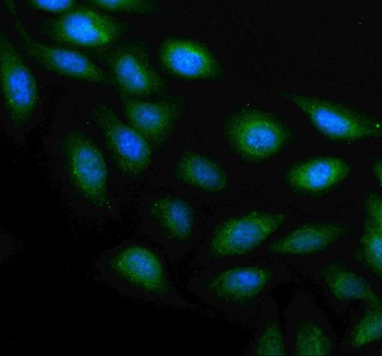 Immunofluorescent staining of PLAAT4 using anti-PLAAT4 antibody. PLAAT4 was detected in an immunocytochemical section of U2OS cells. Enzyme antigen retrieval was performed using IHC enzyme antigen retrieval reagent for 15 mins. The cells were blocked with 10% goat serum. And then incubated with 5 ug/ml rabbit anti-PLAAT4 antibody overnight at 4oC. DyLight 488 Conjugated Goat Anti-Rabbit IgG was used as secondary antibody at 1:500 dilution and incubated for 30 minutes at 37oC. The section was counterstained with DAPI nuclear stain (blue). Visualize using a fluorescence microscope and filter sets appropriate for the label used.