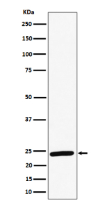 Western blot analysis of RAB8A expression in human HeLa cell lysate using RAB8A antibody. Predicted molecular weight ~24 kDa.