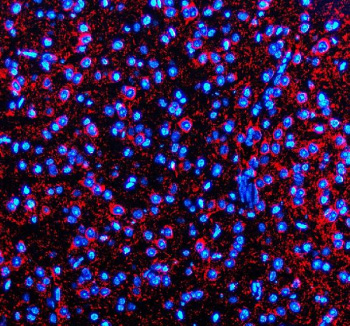 Immunofluorescent staining of Synaptotagmin-10/SYT10 using anti-SYT10 antibody (red). Synaptotagmin-10/SYT10 was detected in a paraffin-embedded section of mouse brain tissue. Heat mediated antigen retrieval was performed in EDTA buffer (pH 8.0, epitope retrieval solution). The tissue section was blocked with 10% goat serum. The tissue section was then incubated with 5 ug/ml rabbit anti-SYT10 antibody overnight at 4oC. Cy3 Conjugated Goat Anti-Rabbit IgG was used as secondary antibody at 1:500 dilution and incubated for 30 minutes at 37oC. The section was counterstained with DAPI nuclear stain (blue). Visualize using a fluorescence microscope and filter sets appropriate for the label used.