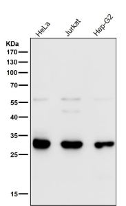 Western blot testing of human samples using the VAPA antibody at 1:1000 dilution for 1 hour at room temperature. Predicted molecular weight ~28 kDa.