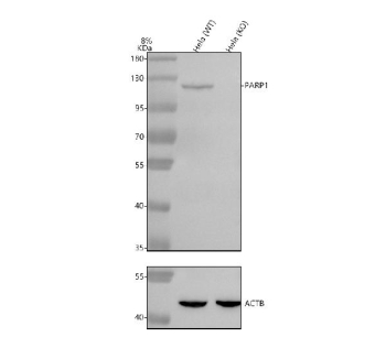 Western blot analysis of PARP1 using anti-PARP1 antibody. Electrophoresis was performed on a 8% SDS-PAGE gel at 80V (Stacking gel) / 120V (Resolving gel) for 2 hours. Lane 1: human Hela- WT whole cell lysates, Lane 2: human Hela-PARP1 KO whole cell lysates. After electrophoresis, proteins were transferred to a nitrocellulose membrane at 150 mA for 50-90 minutes. Blocked the membrane with 5% non-fat milk/TBS for 1.5 hour at RT. Then the membrane was incubated with rabbit anti-PARP1 antibody at 0.5 ug/ml overnight at 4oC, then washed with TBS-0.1%Tween 3 times with 5 minutes each and probed with a goat anti-rabbit IgG-HRP secondary antibody at a dilution of 1:5000 for 1.5 hour at RT. The signal was developed using an ECL Plus Western Blotting Substrate. A specific band was detected for PARP1 at approximately 113 kDa. The expected molecular weight of PARP1 is ~113 kDa.