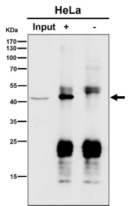 Immunoprecipitation analysis using the antibody at 1:50 dilution. Western blot at 1:1000 dilution. Predicted molecular weight ~46 kDa.