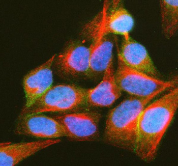 Immunofluorescent staining of PIP5K1A using anti-PIP5K1A antibody (green) and anti-Beta Tubulin antibody (red). PIP5K1A was detected in an immunocytochemical section of Hela cells. Enzyme antigen retrieval was performed using IHC enzyme antigen retrieval reagent for 15 mins. The cells were blocked with 10% goat serum. And then incubated with 5 ug/ml rabbit anti-PIP5K1A antibody and mouse anti-Beta Tubulin antibody overnight at 4oC. DyLight 488 Conjugated Goat Anti-Rabbit IgG and Cy3 Conjugated Goat Anti-Mouse IgG were used as secondary antibody at 1:500 dilution and incubated for 30 minutes at 37oC. Visualize using a fluorescence microscope and filter sets appropriate for the label used.