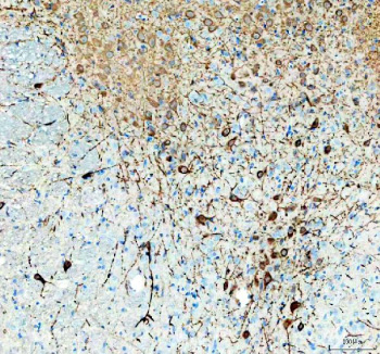 Immunohistochemical staining of TPH2 using anti-TPH2 antibody. TPH2 was detected in a paraffin-embedded section of rat brain tissue. Heat mediated antigen retrieval was performed in EDTA buffer (pH 8.0, epitope retrieval solution). The tissue section was blocked with 10% goat serum. The tissue section was then incubated with 1:50 rabbit anti-TPH2 antibody overnight at 4oC. Peroxidase Conjugated Goat Anti-rabbit IgG was used as secondary antibody and incubated for 30 minutes at 37oC. The tissue section was developed using an HRP secondary and DAB substrate.