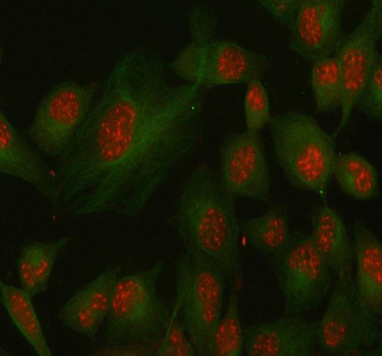 Immunofluorescent staining of SSH3 using anti-SSH3 antibody (red) and anti-Beta Tubulin antibody (green). SSH3 was detected in immunocytochemical section of human HELA cell. Enzyme antigen retrieval was performed using IHC enzyme antigen retrieval reagent for 15 mins. The cells were blocked with 10% goat serum. And then incubated with 5 ug/ml rabbit anti-SSH3 antibody and mouse anti-Beta Tubulin antibody overnight at 4oC. Cy3 Conjugated Goat Anti-Rabbit IgG and FITC Conjugated Goat Anti-Mouse IgG were used as secondary antibody at 1:500 dilution and incubated for 30 minutes at 37oC. Visualize using a fluorescence microscope and filter sets appropriate for the label used.