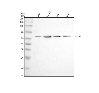 Western blot analysis of SOCS7 using anti-SOCS7 antibody. Lane 1: human Hela whole cell lysates, Lane 2: human HepG2 whole cell lysates, Lane 3: human RT4 whole cell lysates, Lane 4: human whole cell lysates. After electrophoresis, proteins were transferred to a nitrocellulose membrane at 150 mA for 50-90 minutes. Blocked the membrane with 5% non-fat milk/TBS for 1.5 hour at RT. The membrane was incubated with rabbit anti-SOCS7 antibody at 1:500 overnight at 4oC, then washed with TBS-0.1%Tween 3 times with 5 minutes each and probed with a goat anti-rabbit IgG-HRP secondary antibody at a dilution of 1:5000 for 1.5 hour at RT. The signal was developed using enhanced chemiluminescent. A band is detected in the commonly cited 58-63 kDa range. This migration is consistent with endogenous SOCS7 and reflects differences in phosphorylation state and isoform usage, which modestly alter SDS-PAGE mobility.