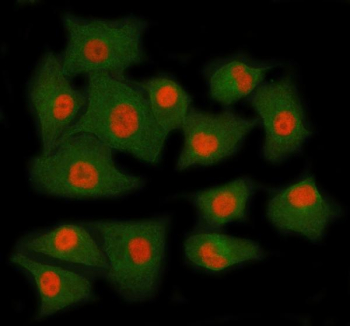 Immunofluorescent staining of RING1 using anti-RING1 antibody (red) and anti-Beta Tubulin antibody (green). RING1 was detected in immunocytochemical section of cell. Enzyme antigen retrieval was performed using IHC enzyme antigen retrieval reagent for 15 mins. The cells were blocked with 10% goat serum. And then incubated with 5 ug/ml rabbit anti-RING1 antibody and mouse anti-Beta Tubulin antibody overnight at 4oC. Cy3 Conjugated Goat Anti-Rabbit IgG and FITC Conjugated Goat Anti-Mouse IgG were used as secondary antibody at 1:500 dilution and incubated for 30 minutes at 37oC. Visualize using a fluorescence microscope and filter sets appropriate for the label used.