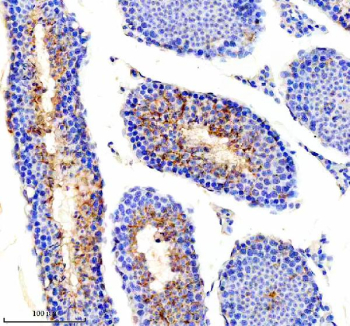 Immunohistochemical staining of PICK1 using anti-PICK1 antibody. PICK1 was detected in a paraffin-embedded section of mouse testis tissue. Heat mediated antigen retrieval was performed in EDTA buffer (pH 8.0, epitope retrieval solution). The tissue section was blocked with 10% goat serum. The tissue section was then incubated with 2 ug/ml rabbit anti-PICK1 antibody overnight at 4oC. Peroxidase Conjugated Goat Anti-rabbit IgG was used as secondary antibody and incubated for 30 minutes at 37oC. The tissue section was developed using an HRP secondary and DAB substrate.