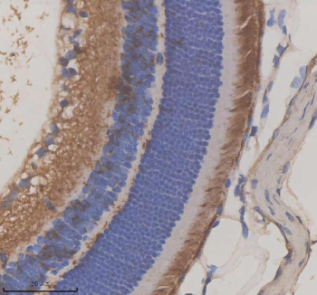 Immunohistochemical staining of GRK1 using anti-GRK1 antibody. GRK1 was detected in a paraffin-embedded section of mouse eye tissue. Heat mediated antigen retrieval was performed in EDTA buffer (pH 8.0, epitope retrieval solution). The tissue section was blocked with 10% goat serum. The tissue section was then incubated with 2 ug/ml rabbit anti-GRK1 antibody overnight at 4oC. Peroxidase Conjugated Goat Anti-rabbit IgG was used as secondary antibody and incubated for 30 minutes at 37oC. The tissue section was developed using an HRP secondary and DAB substrate.