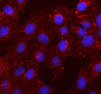 Immunofluorescent staining of SSH1 using anti-SSH1 antibody (red). SSH1 was detected in an immunocytochemical section of U2OS cells. Enzyme antigen retrieval was performed using IHC enzyme antigen retrieval reagent for 15 mins. The cells were blocked with 10% goat serum. And then incubated with 5 ug/ml rabbit anti-SSH1 antibody overnight at 4oC. Cy3 Conjugated Goat Anti-Rabbit IgG was used as secondary antibody at 1:500 dilution and incubated for 30 minutes at 37oC. The section was counterstained with DAPI nuclear stain (blue). Visualize using a fluorescence microscope and filter sets appropriate for the label used.