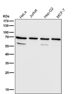 Western blot testing of human samples using the RPN1 antibody at 1:3000 dilution for 1 hour at room temperature. A predominant band is detected at an approximately 68 kDa in all samples, consistent with the mature N-glycosylated ER membrane protein ribophorin I described in the literature. Additional weaker bands between roughly 50 and 60 kDa, likely represent truncated or processed RPN1 species generated during normal ER associated degradation rather than distinct full length isoforms.