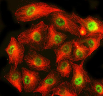 Immunofluorescent staining of CHP1 using anti-CHP1 antibody (green) and anti-Beta Tubulin antibody (red). CHP1 was detected in an immunocytochemical section of human A549 cells. Enzyme antigen retrieval was performed using IHC enzyme antigen retrieval reagent for 15 mins. The cells were blocked with 10% goat serum. And then incubated with 5 ug/ml rabbit anti-CHP1 antibody and mouse anti-Beta Tubulin antibody overnight at 4oC. DyLight 488 Conjugated Goat Anti-Rabbit IgG and Cy3 Conjugated Goat Anti-Mouse IgG were used as secondary antibody at 1:500 dilution and incubated for 30 minutes at 37oC. Visualize using a fluorescence microscope and filter sets appropriate for the label used. Nuclear and perinuclear staining observed in human cell lines.