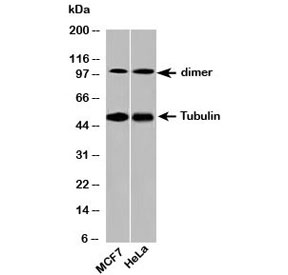 Western blot testing of human samples with beta Tubulin antibody at 2ug/ml. Predicted molecular weight: 50-55 kDa.