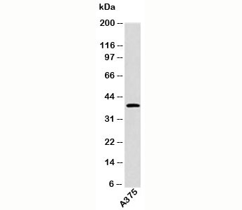 EDG1 antibody western blot of human samples