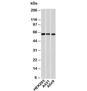 HSP60 antibody western blot with human samples