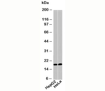 Acid Phosphatase / AP1 antibody western blot of human samples