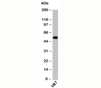 Neurotensin Receptor antibody western blot of human samples