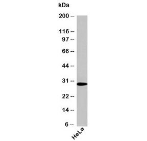 Western blot testing of human samples using NQO1 antibody at 1ug/ml. Predicted molecular weight ~30kDa.