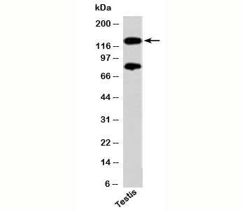 PER2 Antibody western blot of human samples
