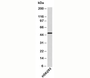 ATG4B antibody western blot of human sampes
