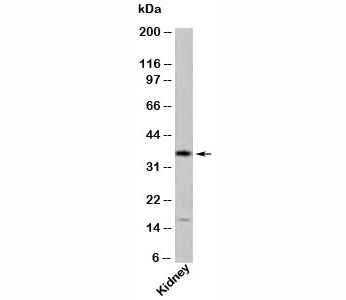 GBL antibody western blot of human samples