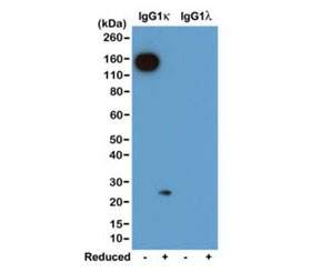 Western blot of nonreduced(-) and reduced(+) mouse IgG1Îº and IgG1Î» (20ng/lane), using 0.2ug/mL of recombinant Mouse Kappa Light Chain antibody. This mAb reacts to nonreduced IgG1Îº (~150 kDa), and slightly reacts to reduced Îº light chain (~25 kDa).