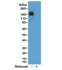 Western blot of nonreduced(-) and reduced(+) mouse IgA, using 0.5ug/mL of recombinant Mouse IgA antibody. This antibody reacts to nonreduced IgA.