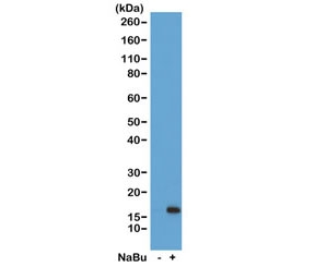 Western blot of acid extracts from HeLa cells untreated (-) or treated (+) with sodium butyrate using recombinant H3K36ac antibody at 1 ug/ml showed a band of Histone H3 acetylated at Lysine 36 in treated HeLa cells.