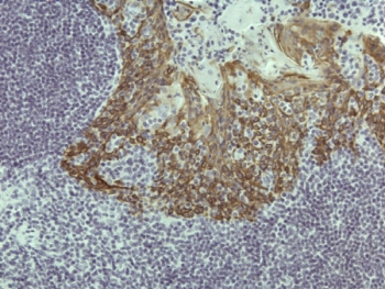 IHC staining of FFPE human tonsil tissue with recombinant CK5 antibody.