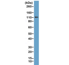 Western blot of human MCF7 lysate using recombinant E-Cadherin antibody at 1:1000. Expected molecular weight: 135 kDa (precursor), 80-120 kDa (mature, depending on glycosylation level).