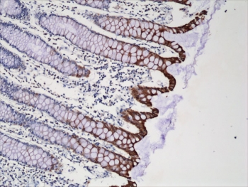 IHC testing of FFPE human colon tissue with recombinant CK20 antibody at 1:250.