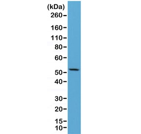 Western blot of human HeLa lysate using recombinant CK7 antibody at 1:2500. Predicted molecular weight ~51 kDa.