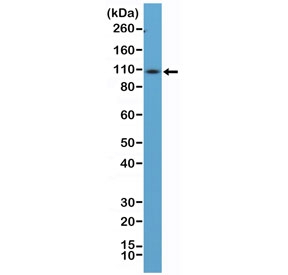 Western blot testing of mouse spleen tissue lysate using recombinant CD34 antibody at 1:100 dilution. Observed molecular weight: 41~110 kDa depending on level of glycosylation.