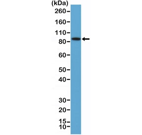 Western blot testing of human K562 cell lysate with recombinant BRAF antibody at 1:100 dilution. Predicted molecular weiight ~84 kDa.