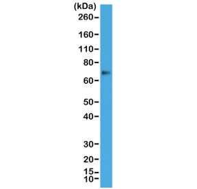 Western blot test of human A431 cell lysate with recombinant p63 antibody at 1:1000. Expected molecular weight: 63-77 kDa.
