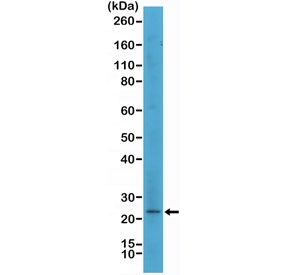 Western blot testing of human SK-MEL-2 cell lysate with recombinant MART1 antibody at 1:500. Expected molecular weight ~20 kDa with possible doublet.