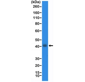 Western blot testing of human TT cell lysate with recombinant Thyroid transcription factor 1 antibody at 1:20,000 dilution. Expected molecular weight: 38-45 kDa.