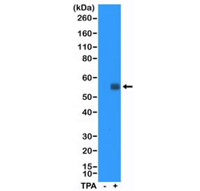 Western blot testing of lysate from HeLa cells, non-treated (-)or treated (+) with TPA, with recombinant c-Fos antibody at 1:5000 dilution. Expected molecular weight: ~40 kDa (unmodified), 53-68 kDa (phosphorylated).