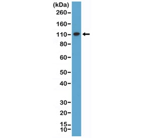 Western blot testing of human HeLa cell lysate with recombinant MSH2 antibody at 1:1000 dilution. Expected molecular weight ~105 kDa.